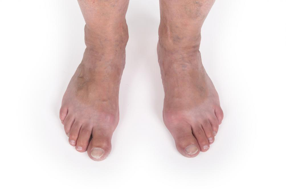 Image showing Veins Treatment Specialist In NYC